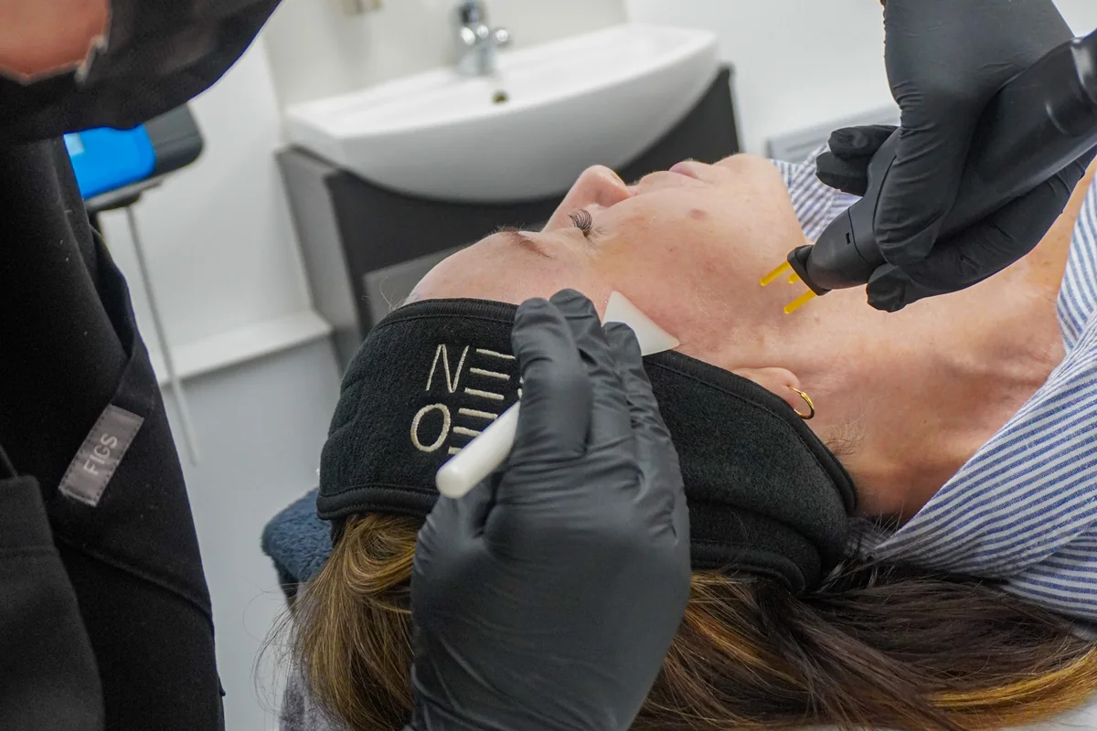 Clinician performing a Neogen facial plasma treatment — iCRYO Westminster, CO wellness guide