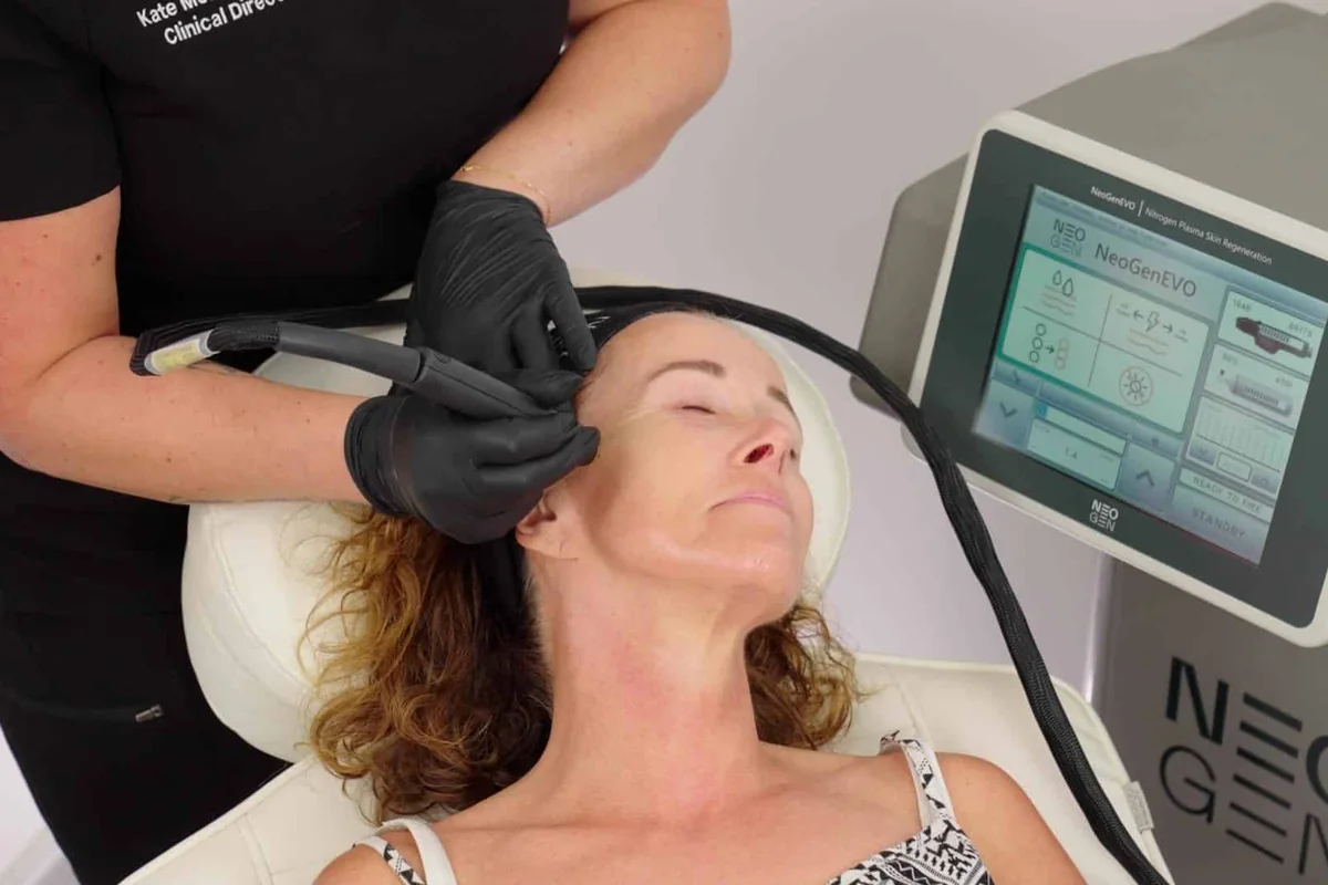 Neogen plasma treatment applied near the temple — iCRYO Westminster, CO wellness guide