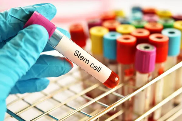 Gloved hand holding a stem cell sample tube — iCRYO Westminster, CO wellness guide