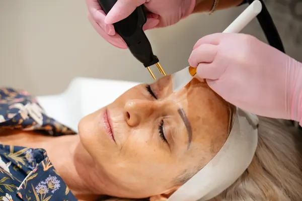 Clinician applying a Neogen treatment handpiece to the face — iCRYO Westminster, CO wellness guide