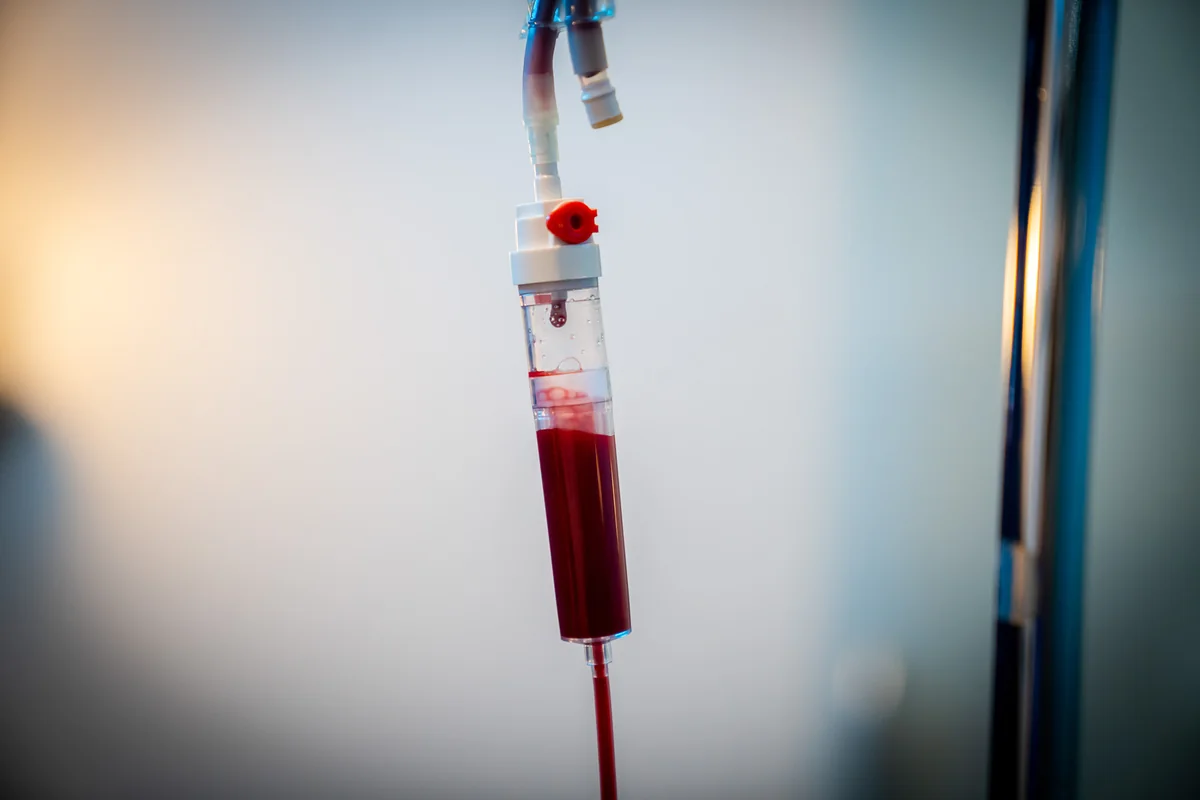 Ozone UV IV infusion equipment and tubing — iCRYO Westminster, CO wellness guide