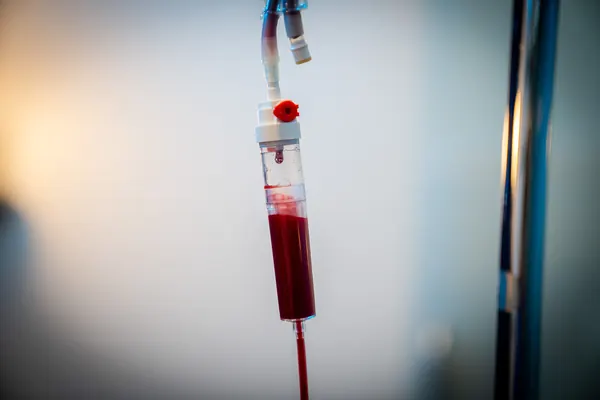 Ozone UV IV infusion equipment and tubing — iCRYO Westminster, CO wellness guide