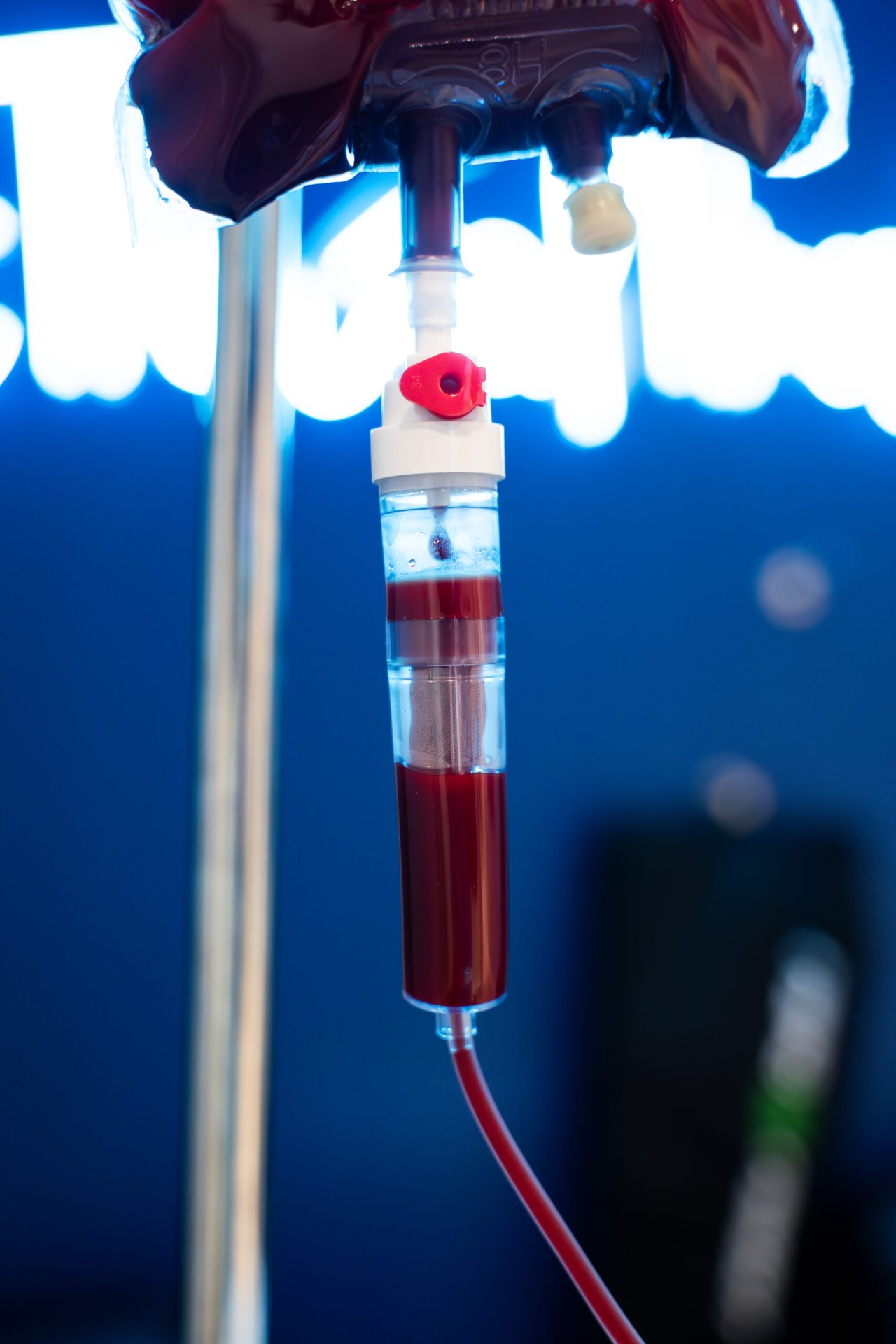 Ozone UV IV therapy filter glowing under UV light at iCRYO Westminster