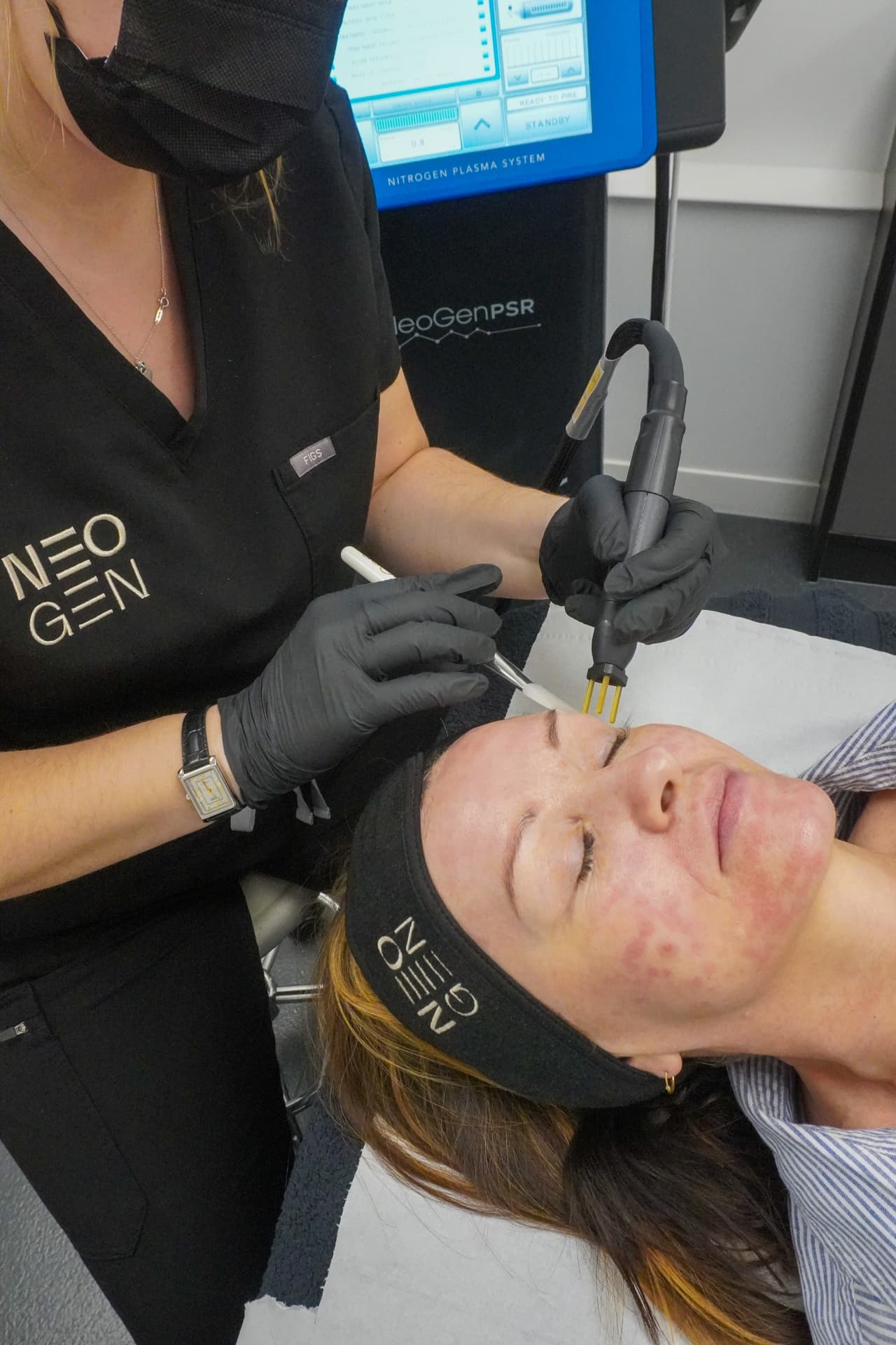 Neogen Face Lift treatment being performed at iCRYO Westminster